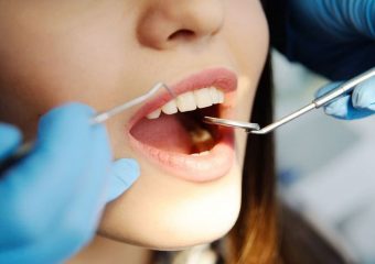 П'ять порад для здоров’я зубів та красивої усмішки