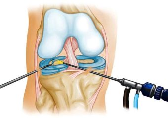 Новини КНП «Ватутінська міська лікарня ВМР»