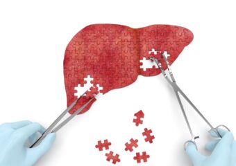 Профілактика передачі вірусного гепатиту В